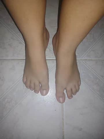 Imagem do pack Pack pé