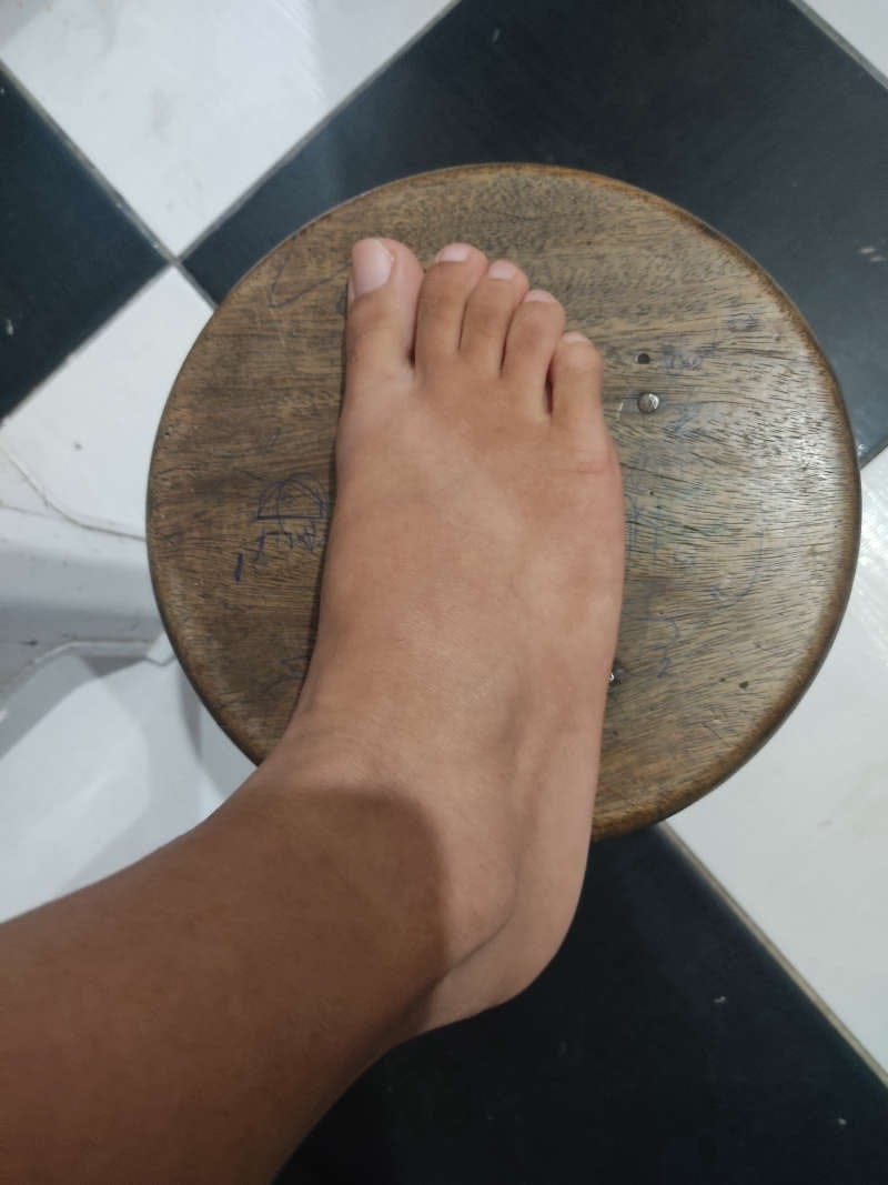 Imagem do pack Pés