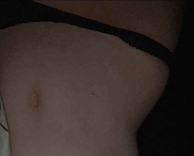 Barriga e peito
