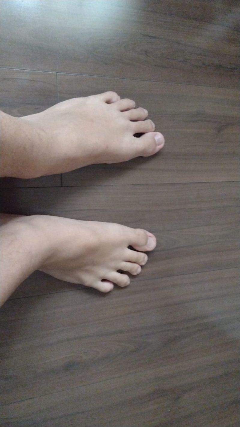 Imagem do pack pack do pé