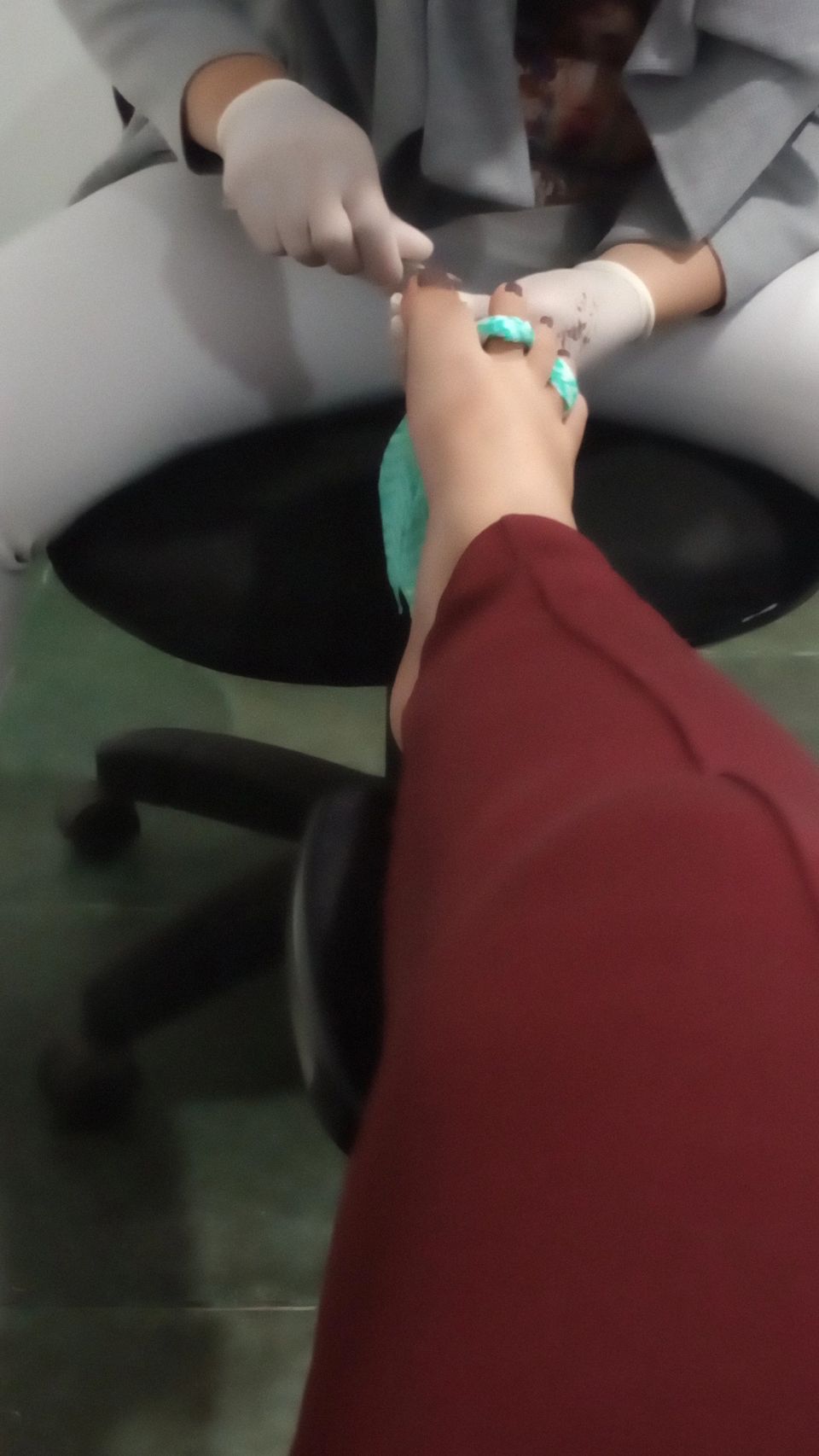 Imagem do pack Pé com unha pintada