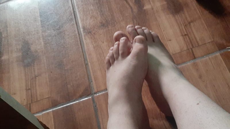 Imagem do pack packzinho do pé