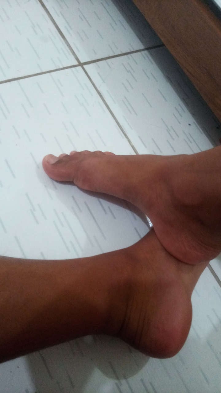 pack do pé