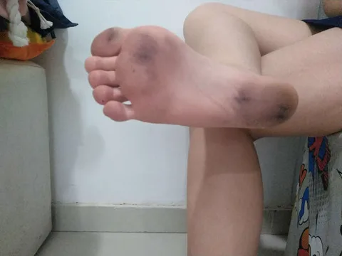 Imagem do pack Pack 1 pé sujo