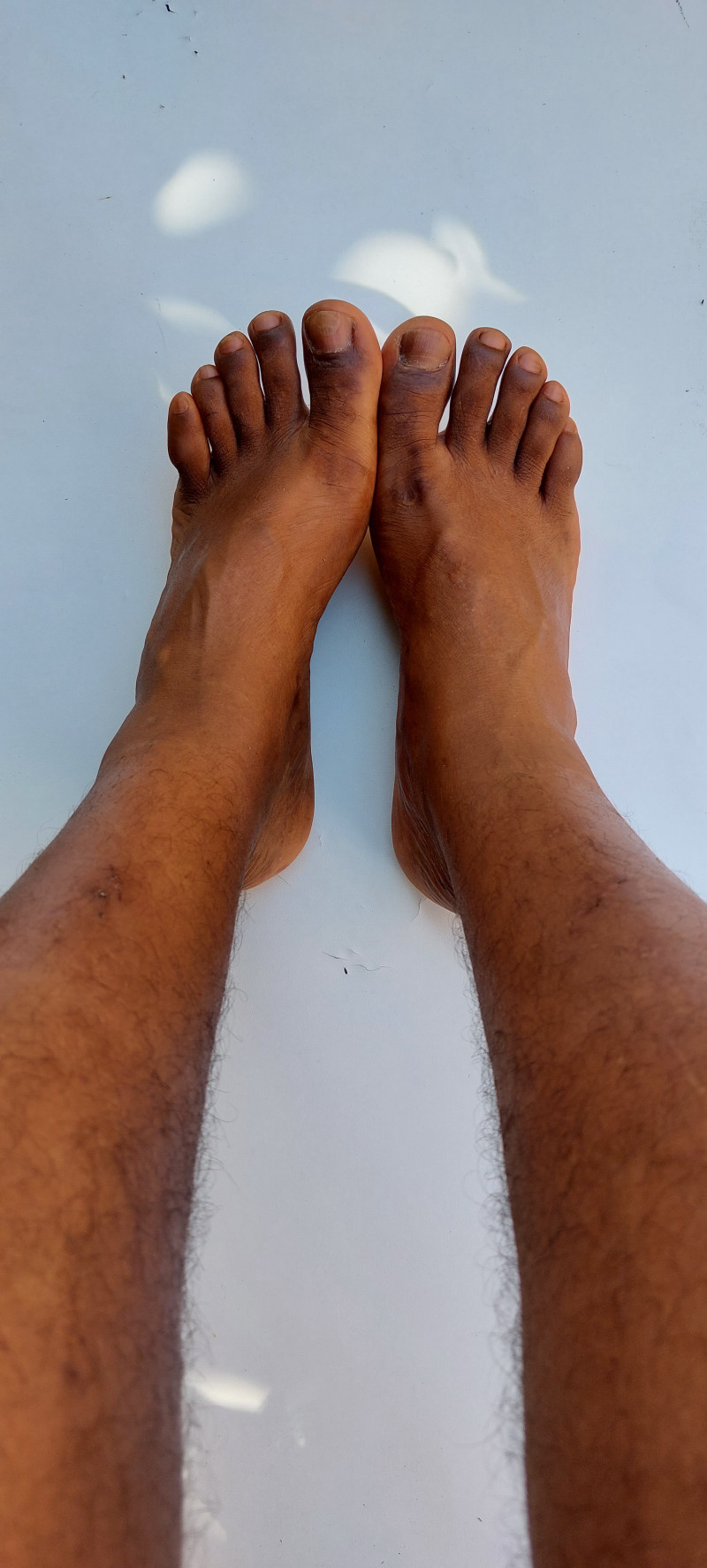 Imagem do pack Pack do pezinho