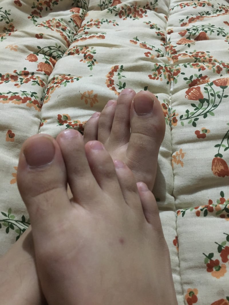 Imagem do pack Pezinhos sem filtro
