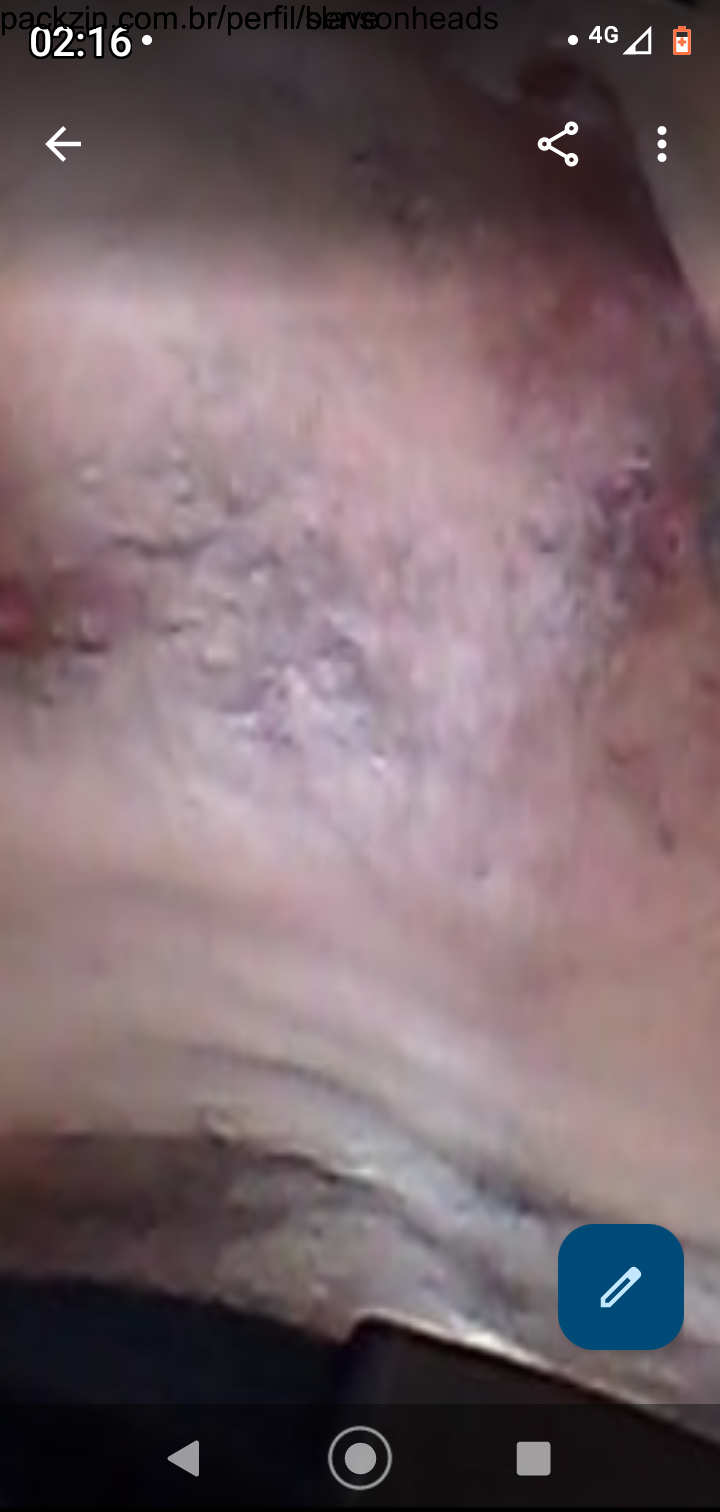 Foto de capa de slave