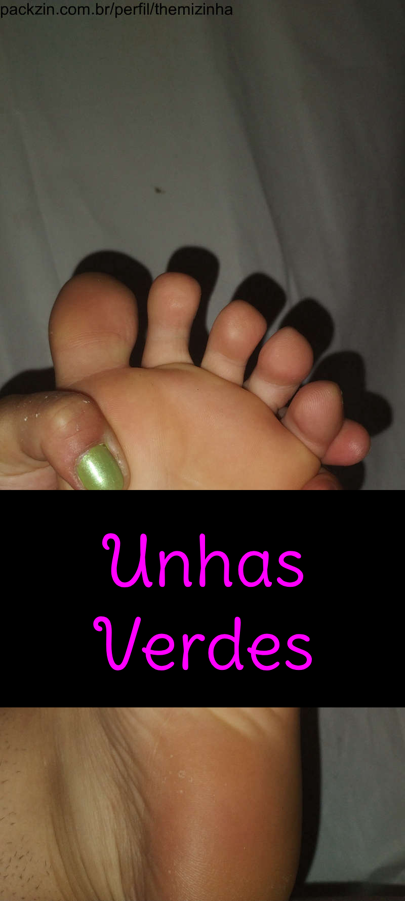Imagem do pack Pezinho unhas verdes 💚